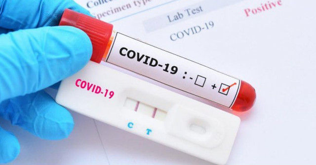 За неделю в Молдове зарегистрировано более 100 случаев заражения COVID-19.