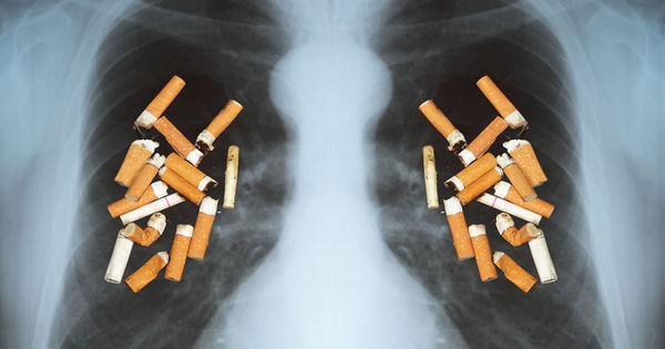Ученые выяснили, почему курящие тяжелее болеют COVID-19. Фото: gazeta.ru.