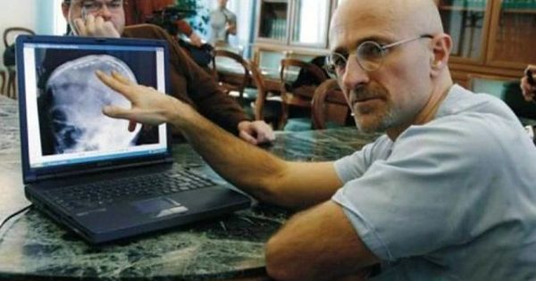 Primul transplant de cap uman a fost efectuat cu succes în China