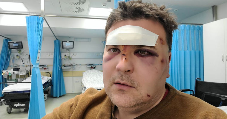 В Тирасполе напали на оппозиционного политика.