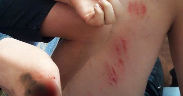 В Бельцах свора собак напала на 12-летнего мальчика.