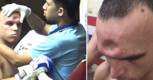Momentul loviturii care i-a făcut unui luptător o gaură în cap