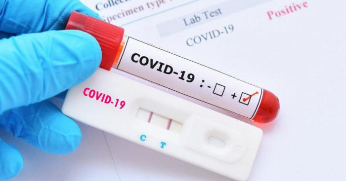 За минувшую неделю было обработано 19 899 тестов на COVID-19.