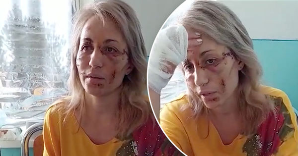 Жительница Сирец раскрыла детали нападения: Сожитель пытался её поджечь. Коллаж Point.md.