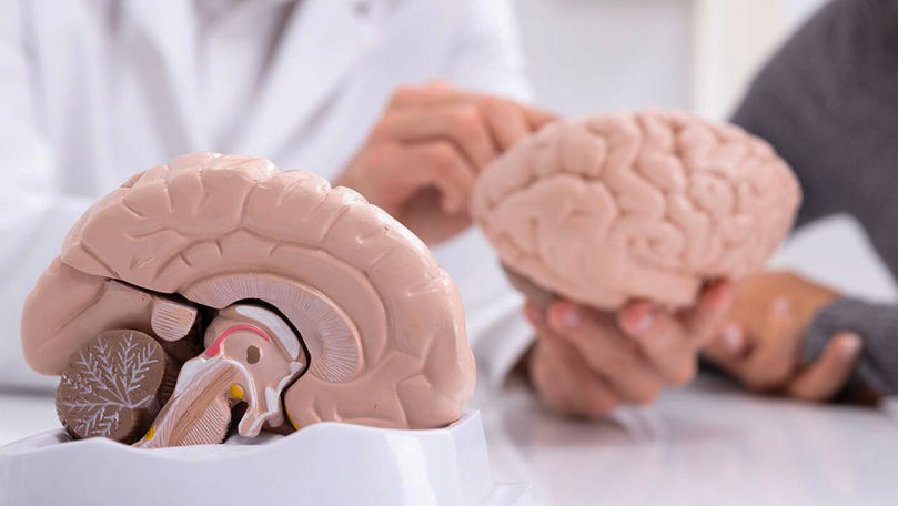 Врач назвала три привычки для сохранения здоровья мозга.