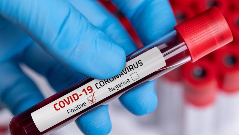 В Молдове зарегистрировали 656 новых случаев COVID-19.