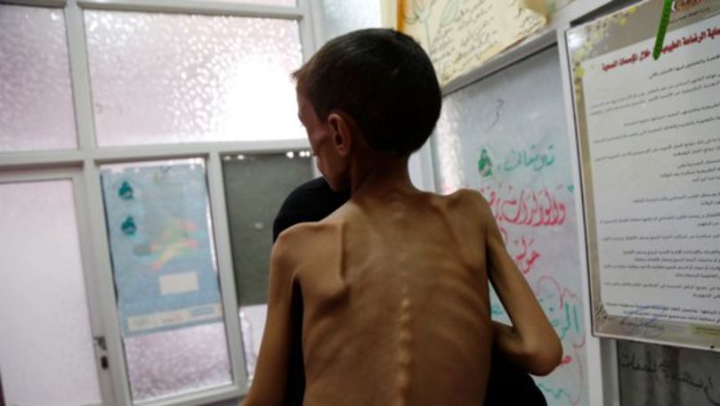 Criză umanitară în Yemen: Peste 13 milioane de oameni suferă de foamete