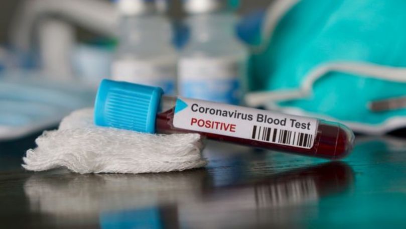 Oficial: Cine e prima moldoveancă infectată cu coronavirus