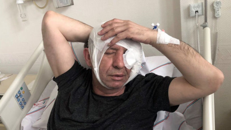 Jurnalist turc, bătut după ce a criticat la TV administrația Erdogan