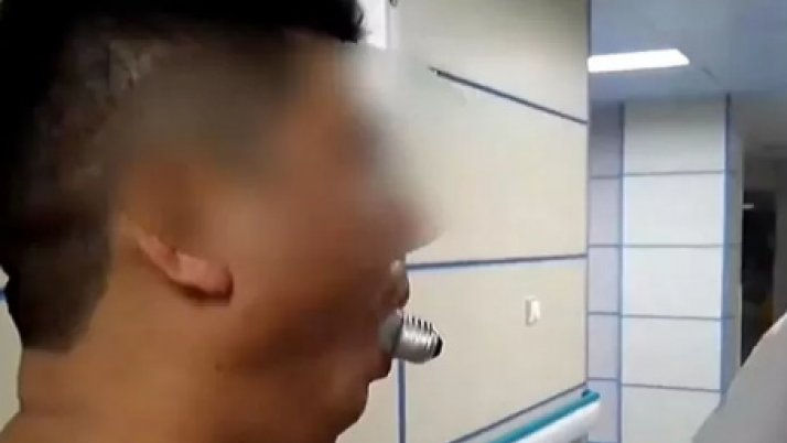 Un bărbat din China a ajuns la urgență cu un bec blocat în gură