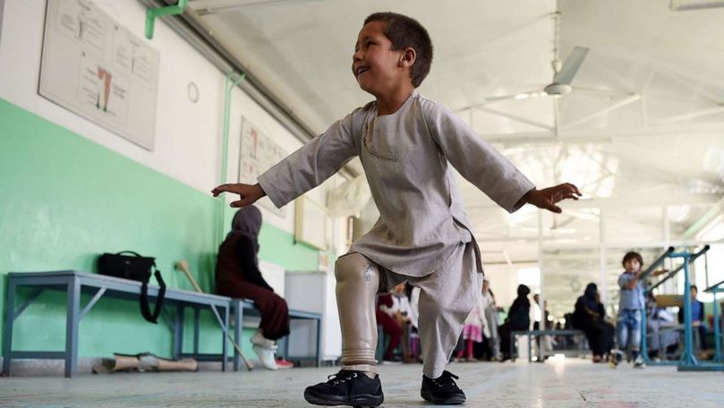 Un băiețel de 5 ani, dansează având o proteză pe picior
