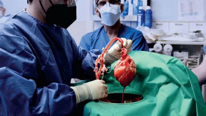 Transplantul de organe de la porc la om: Un pas revoluționar în medicină
