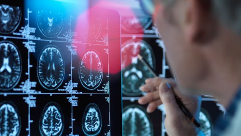 Un medicament pentru tratarea bolii Alzheimer este aproape de autorizare