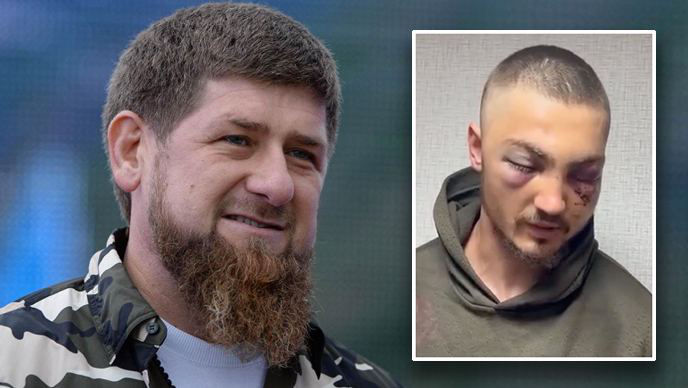 Kadîrov, despre un soldat ce apare cu ochii vineți: A călcat pe greblă