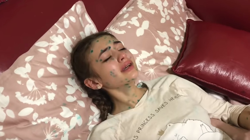 S-a molipsit de varicelă: Iuliana Beregoi a filmat un vlog despre boală