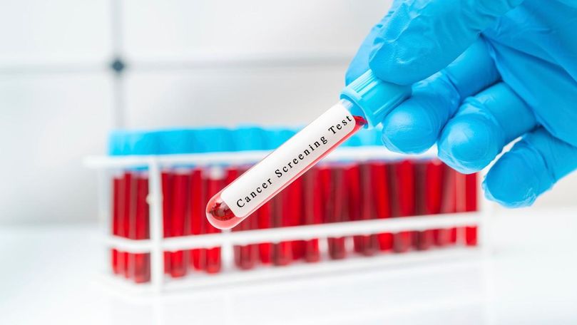 Un test de sânge ar putea detecta peste 50 de tipuri de cancer