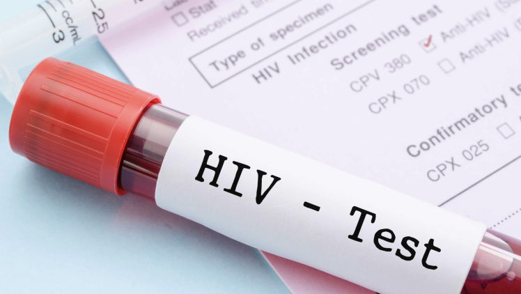 HIV în R. Moldova: Testarea este gratuită, dar mulți se tem să o facă
