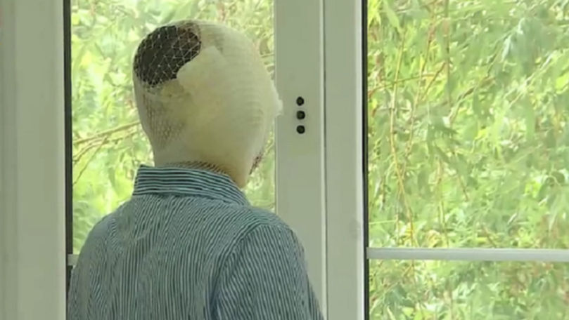 O femeie din Capitală, stropită cu acid de către fostul concubin