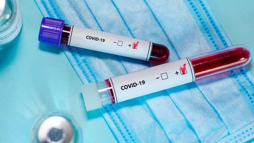 В Молдове зарегистрировали 252 новых случая COVID-19.