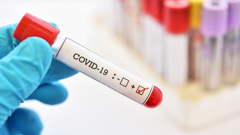 Bilanț: Încă 271 de persoane, infectate cu COVID-19 în R. Moldova