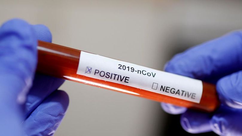 Bilanț: Încă 603 infectați în R. Moldova. Topul regiunilor afectate