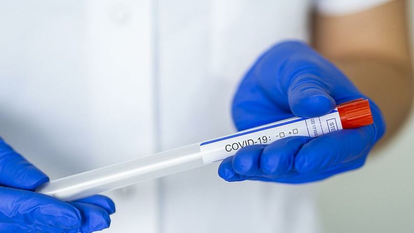 Bilanț: Încă 917 infectați în R. Moldova. Topul regiunilor afectate