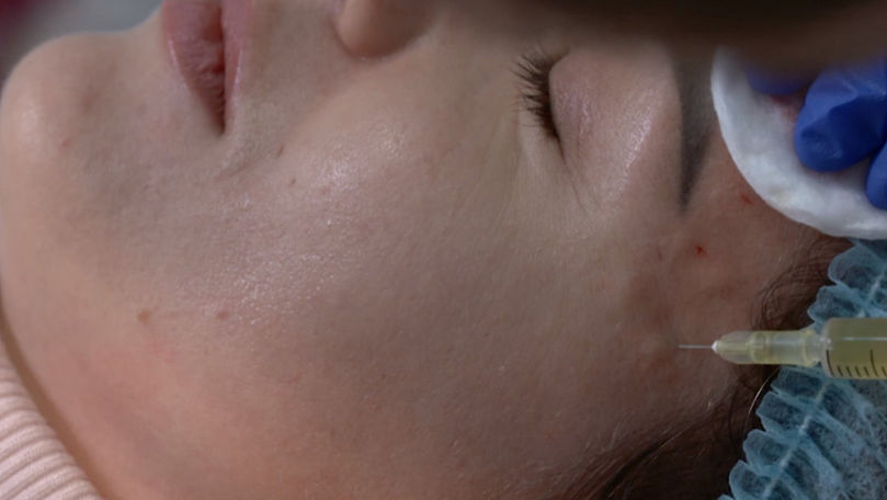 Întinerire cu terapia vampir: Ce trebuie să știi despre plasmolifting