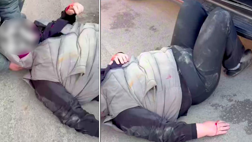 В Комратском районе на пожилую женщину наехал автомобиль.