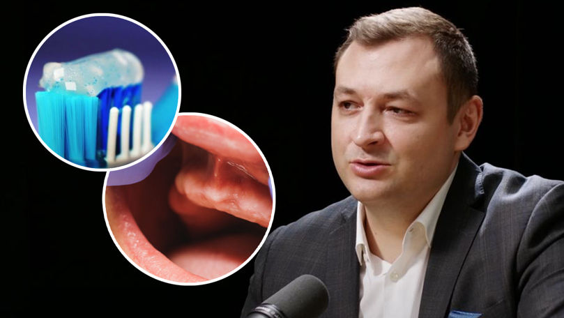 Cauzele pentru care oamenii își pierd dinții, explicate de un medic