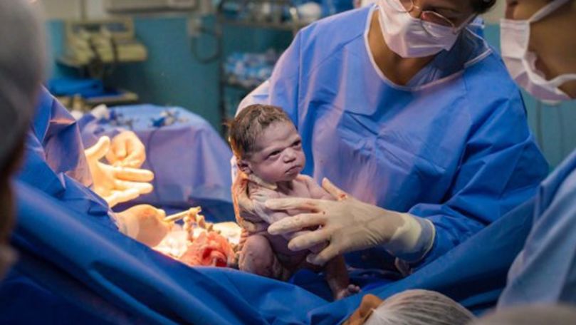 Un bebeluş brazilian a uimit cu gestul pe care l-a făcut după naștere