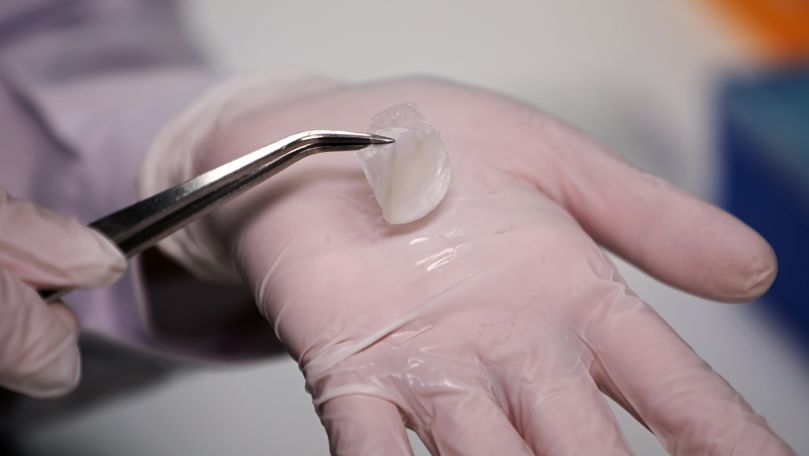 Cercetători din Singapore au reuşit să producă piele umană in-vitro