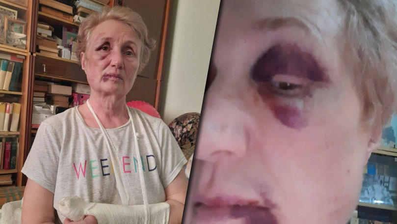 O femeie, bătută în plină zi în Capitală: Mă lovea cu bastonul metalic