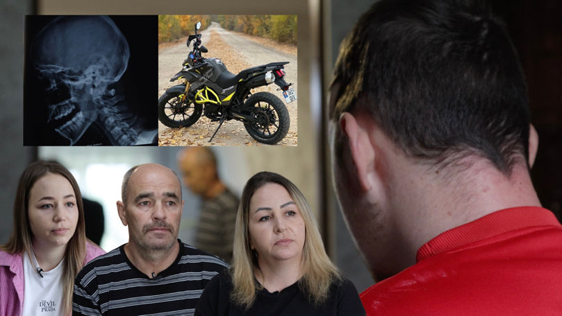 A fost accident sau bătut? Un tânăr acuză doi polițiști de tortură