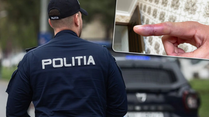 Incident la Buiucani: Un polițist a fost mușcat de deget de un bărbat