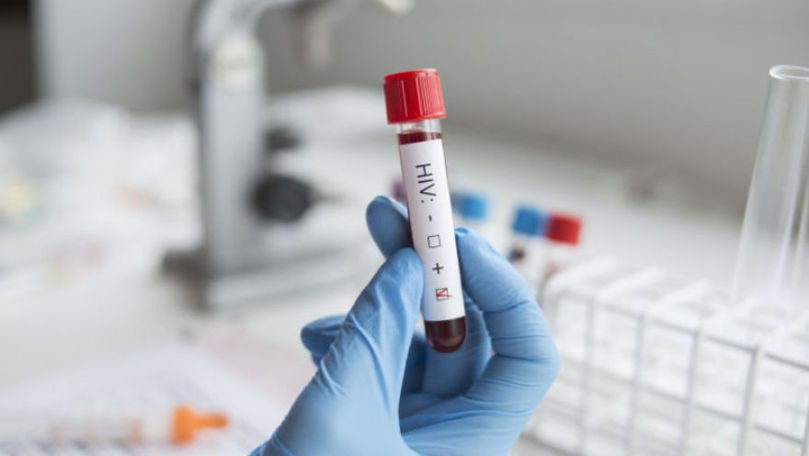 Leac pentru HIV. Cercetătorii sunt aproape să învingă definitiv virusul