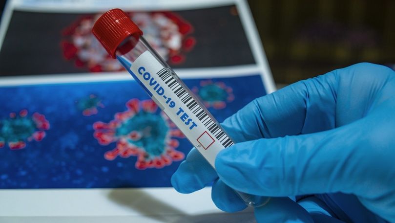 Bilanț: Încă 293 de infectați în Moldova. Câte teste au fost efectuate