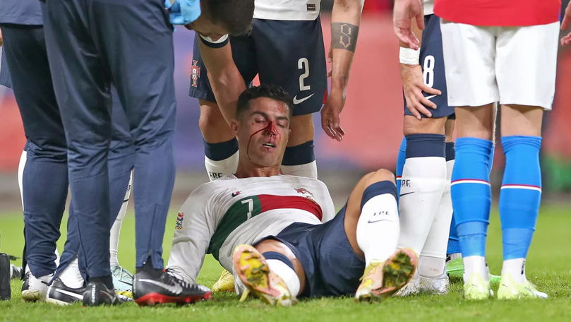 Cristiano Ronaldo și-a spart nasul în meciul Portugaliei - Lovitură