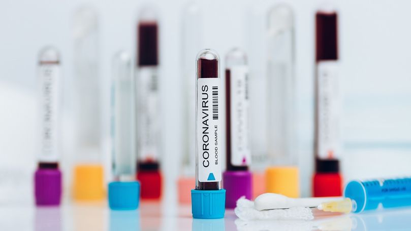 1.934 de infectați în R. Moldova: Câți pacienți sunt în stare gravă