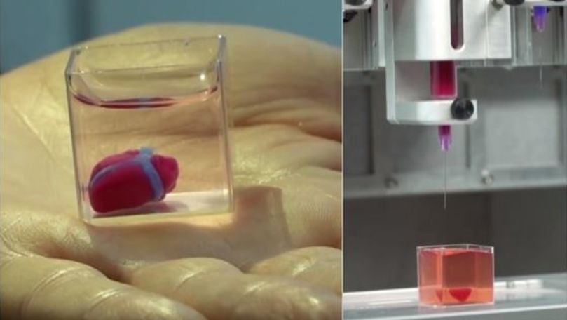 Prima inimă din țesut uman obținută cu o imprimantă 3D