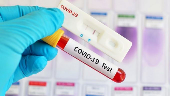 Bilanț COVID-19: Peste 3.800 de infectați într-o săptămână