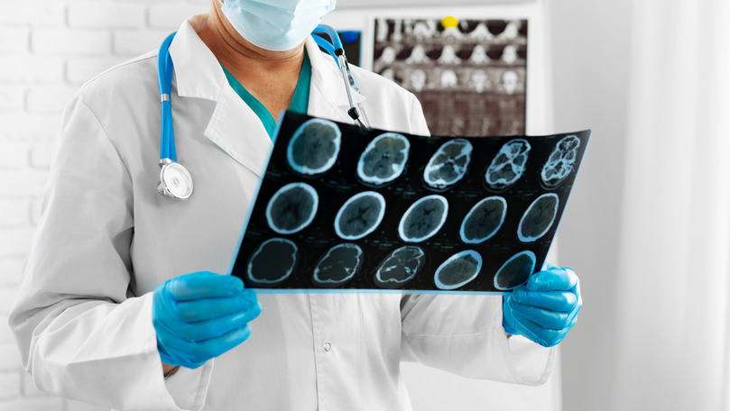 Medic: Numărul cazurilor de afecțiuni neurologice a crescut de 5 ori