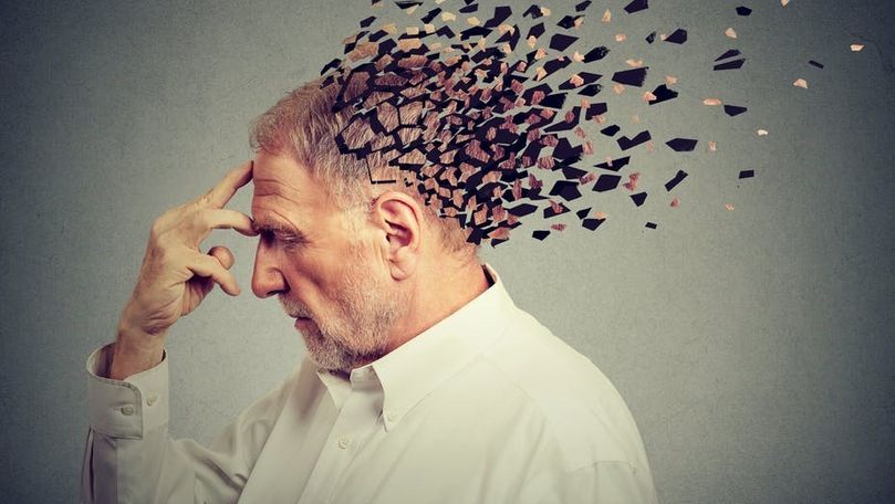 Studiu: A fost descoperită o formă de demenţă asemănătoare cu Alzheimer