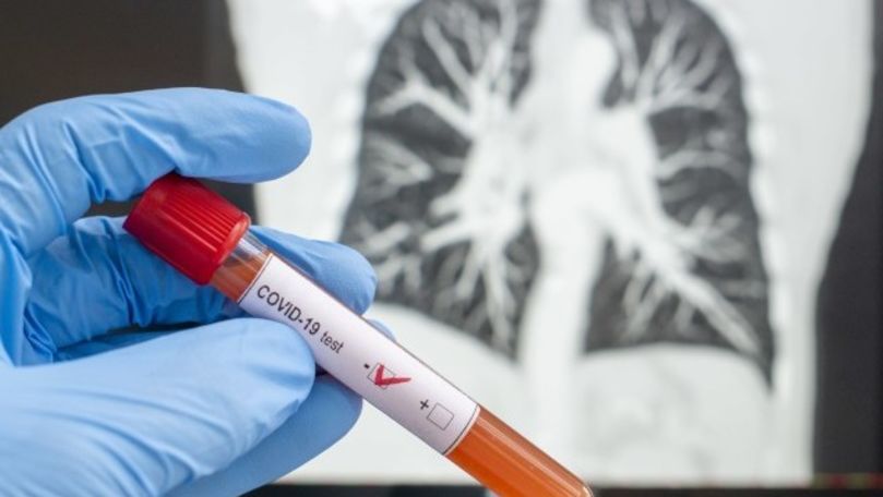 Coronavirus în România: 1.339 de cazuri noi și 47 de decese