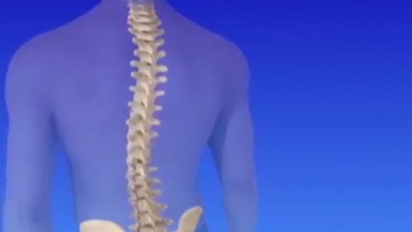 Scolioza: Cauzele apariției acestei maladii și cum putem să o prevenim