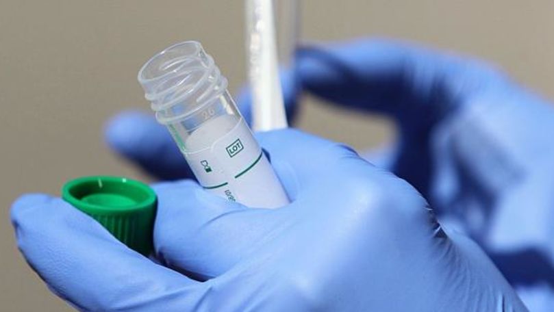 В Молдове возросло число случаев коронавируса.