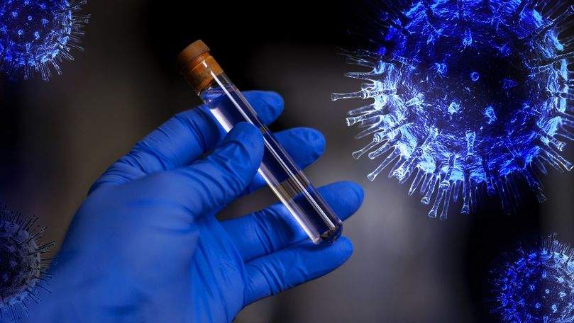 В Молдове зарегистрировали 322 новых случая COVID-19.