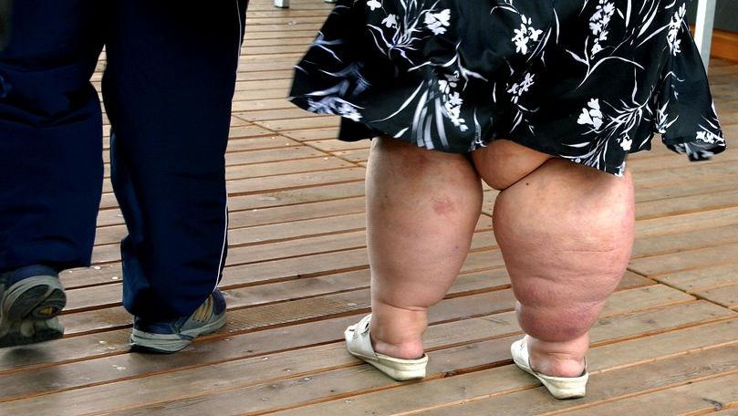 OMS: Până în 2045 un sfert din populația globului va fi obeză