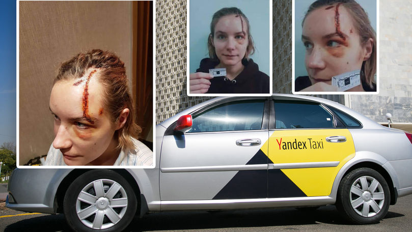 В Молдове пассажирка Yandex taxi пытается добиться справедливости после ДТП.
