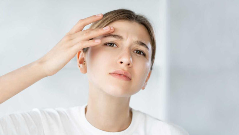 Îngrijirea tenului gras – soluții pentru a controla excesul de sebum