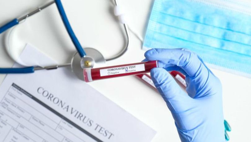 R. Moldova bate record după record la numărul de îmbolnăviri cu COVID-19